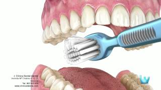 Higiene dental  Clinica identis [upl. by Annawoj]