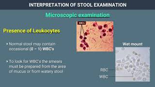 Interpretation of Stool Examination [upl. by Odnolor978]