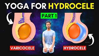 Treat Hydrocele amp Varicocele at Home Part 1  Yoga Exercises for Hydrocele amp Varicocele hydrocele [upl. by Selry]