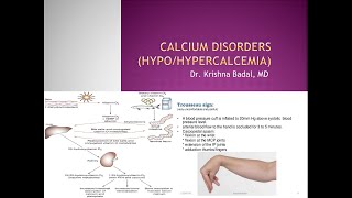 Hypocalcemia and Hypercalcemia in Children [upl. by Imoyik]