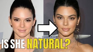 Kendall Jenner Plastic Surgery [upl. by Lebyram78]