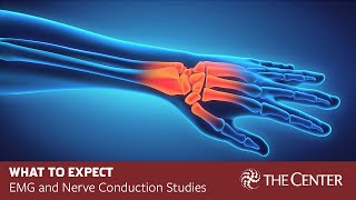 What to Expect During Nerve Conduction Studies and EMG Tests [upl. by Annayhs]