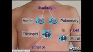 AUSCULTATION OF HEART SOUNDS [upl. by Nnyletak]