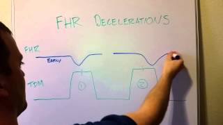 Fetal Heart Rate Decelerations Early Late Variable [upl. by Laeria]