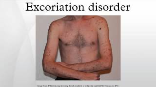 Excoriation disorder [upl. by Efeek]