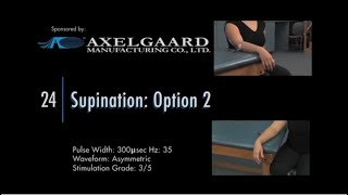 Electrode Placement for Supination Option 2 [upl. by Enatan185]