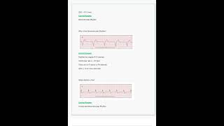 Relias Dysrhythmia Basic A Questions amp Answers All Correct amp Verified [upl. by Occir]