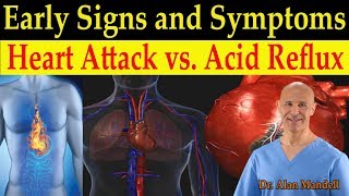 Hypoplastic left heart syndrome and norwood glenn fontan  NCLEXRN  Khan Academy [upl. by Oiramej649]