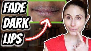 HOW TO FADE DARK LIPS  Dr Dray [upl. by Ardeahp415]