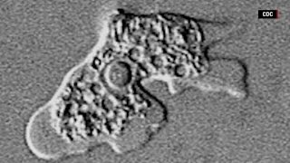 7th CBSE Feeding amp digestion Nutrition in Amoeba [upl. by Roselle604]