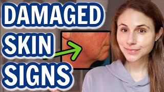 How to tell when your SKIN BARRIER IS DAMAGED Dr Dray [upl. by Anem]