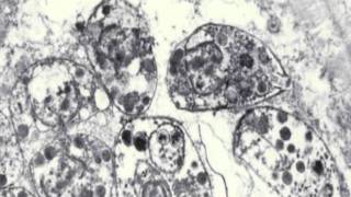 Toxoplasmosis amp Toxoplasma gondii [upl. by Ardnad]