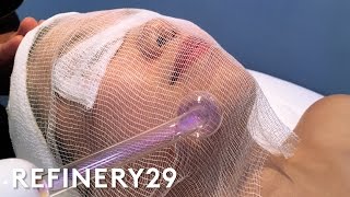 High Frequency Facial For Clear Skin  Beauty With Mi  Refinery29 [upl. by Ailerua]