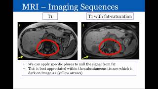 Introduction to Radiology Magnetic Resonance Imaging [upl. by Daffy]