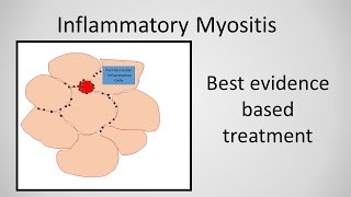 Myositis Inflammatory Myopathy Treatment [upl. by Ron576]