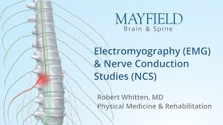 Electromyography EMG amp Nerve conduction studies NCS [upl. by Azer172]