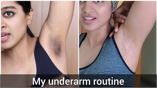 How I Got Rid of My Dark Underarms [upl. by Roleat]