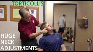 EXTREME neck pain amp TORTICOLLIS are GONE with HUGE NECK ADJUSTMENTs SoCalChiropractic [upl. by Burne]