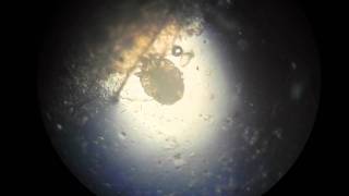 Scabies Mite Video HD [upl. by Hendrickson]