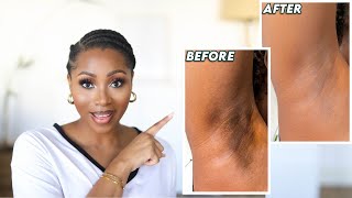 HOW I GOT RID OF MY DARK UNDERARMS  HOW TO BRIGHTEN YOUR ARMPITS  KEEP THEM EVEN amp SMOOTH [upl. by Hurwitz]