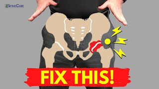 How to Fix a Popping Hip for Good NO EQUIPMENT [upl. by Aicilet352]