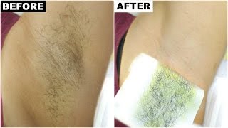 Dark Underarms amp Armpit Hair Removal  BEST amp PERMANENT Solution  Anaysa [upl. by Aket]