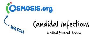 Candidal Infections Osmosis Study Video [upl. by Ileyan238]