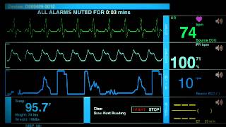 Sonido De Un Hospital [upl. by Tnafni]