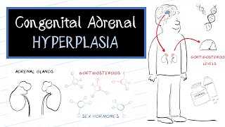 What is Congenital Adrenal Hyperplasia CAH [upl. by Itnava]