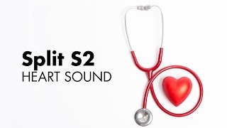 Fixed Split S2  Heart Sounds  MEDZCOOL [upl. by Juana639]