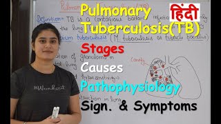 Pulmonary Tuberculosis in Hindi  Stages  Causes  Pathophysiology  Sign amp Symptoms [upl. by Leiahtan88]