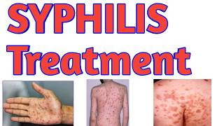 STDs Syphilis Treatment [upl. by Gena]