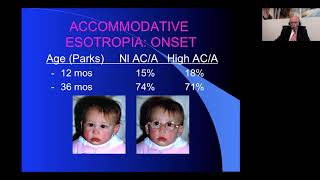 Accommodative Esotropia and its Complications [upl. by Ahrens147]