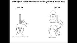 Interpreting the WeberRinne Tests EXPLAINED [upl. by Wachter580]