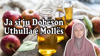 Ja si ju Dobeson Uthulla e Molles  Pyetje Përgjigje [upl. by Andri199]