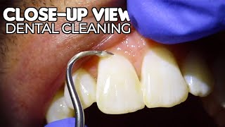 Dental Cleaning  CloseUp View ASMR [upl. by Niad947]