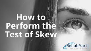 How to Perform the Test of Skew for Vertigo [upl. by Esialb]