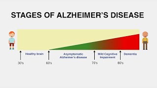 Diagnosing Alzheimer’s Disease [upl. by Hibbitts]