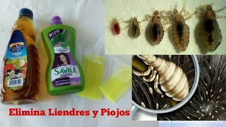 Cómo quitar Liendres y Piojos de manera natural  Remedio casero [upl. by Nnylahs]