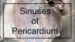 Sinuses of Pericardium Anatomy [upl. by Gilboa]