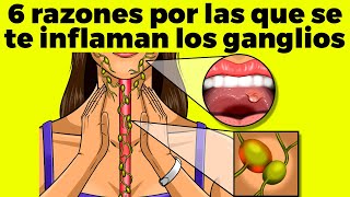 6 RAZONES POR LAS QUE SE TE INFLAMAN LOS GANGLIOS [upl. by Auhsot53]