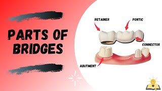 Parts of Bridge  Fixed Partial Denture FPD [upl. by Tavia183]