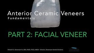 Anterior Ceramic Veneers Part 2 Facial Veneer [upl. by Yee]