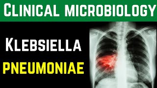 Klebsiella Pneumoniae Clinical Pathogenesis Investigations Treatment Prevention  Dr MubasharAta [upl. by Eelrak]