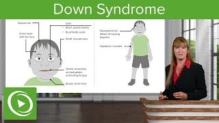 Down Syndrome – Genetics  Lecturio [upl. by Honebein]