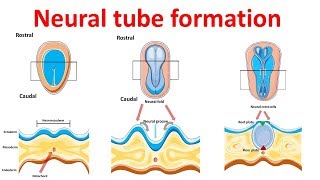 neural tube formation  Embryology  Neurulation [upl. by Lanrev]