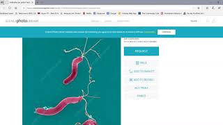 Endospore Stain and Bacterial Motility [upl. by Brandtr490]