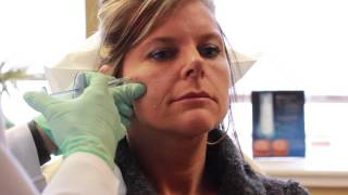 Juvederm Voluma XC Demonstration [upl. by Thevenot750]