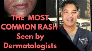 How to treat rashes on hands  Dr Rasya Dixit [upl. by Wivinia288]