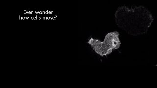 Growing AMOEBA for microscopy 🔬 176 [upl. by Cis]